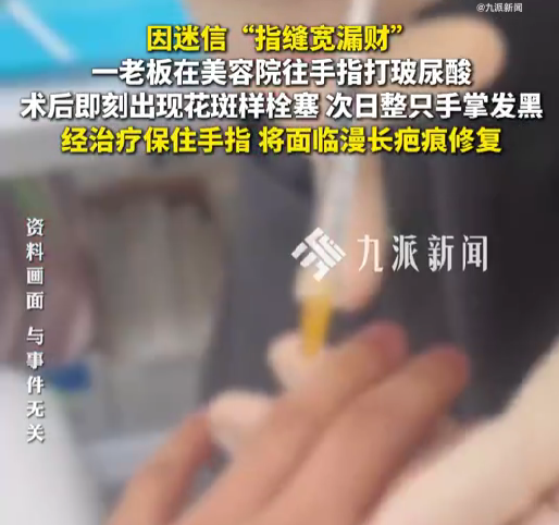 医生回应男子往手指打玻尿酸