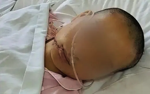 一女子被家暴起诉离婚遭丈夫砍成重伤 妇联:将努力提供帮助