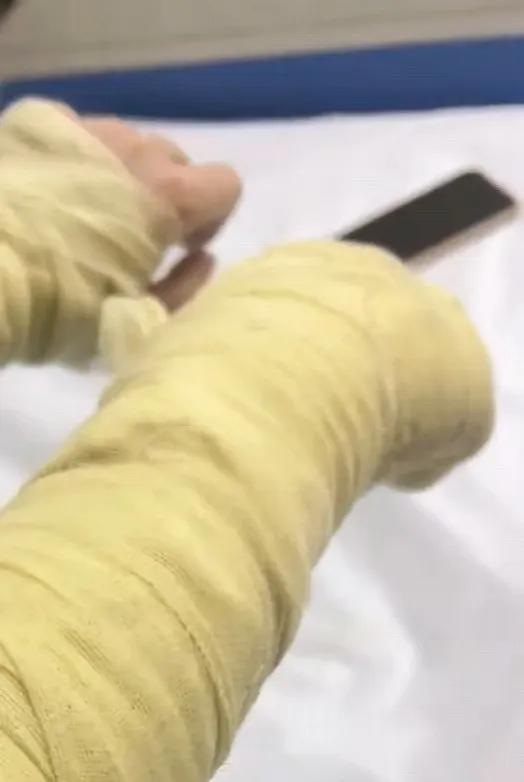 男子自制易燃物泄私愤烧伤女主播 案件明日一审开庭