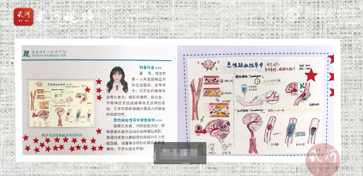 医者仁心！18名医生为患者手绘手术讲解图