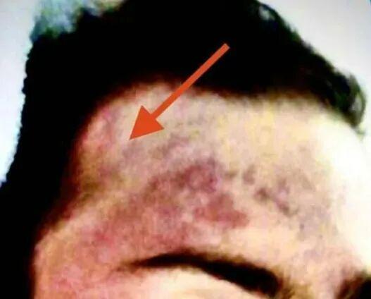 番邦母亲看东谈主体展览发现女儿遗体 真相扑朔迷离