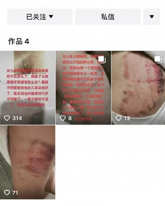男子打女儿致耳穿孔被拘