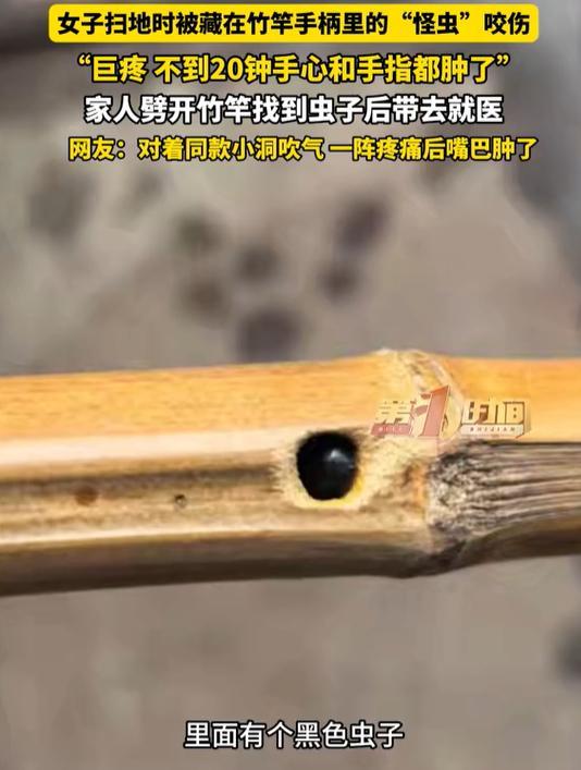 女子扫地时被扫把竹竿手柄里的“怪虫”咬伤