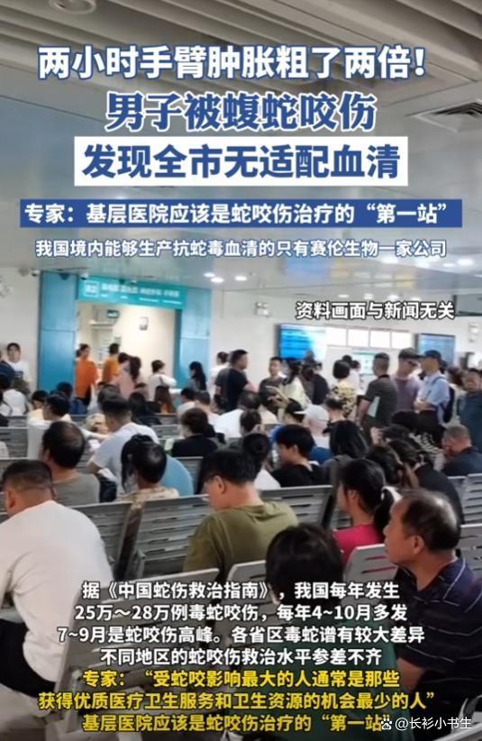 男子野外抓蛇被咬后手变黑肿胀 紧急求医路途艰难