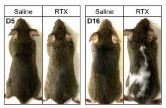 白头发拔一根长三根？到底能不能拔