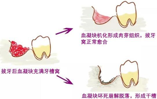 女子嘴里發(fā)出糞便般腐臭