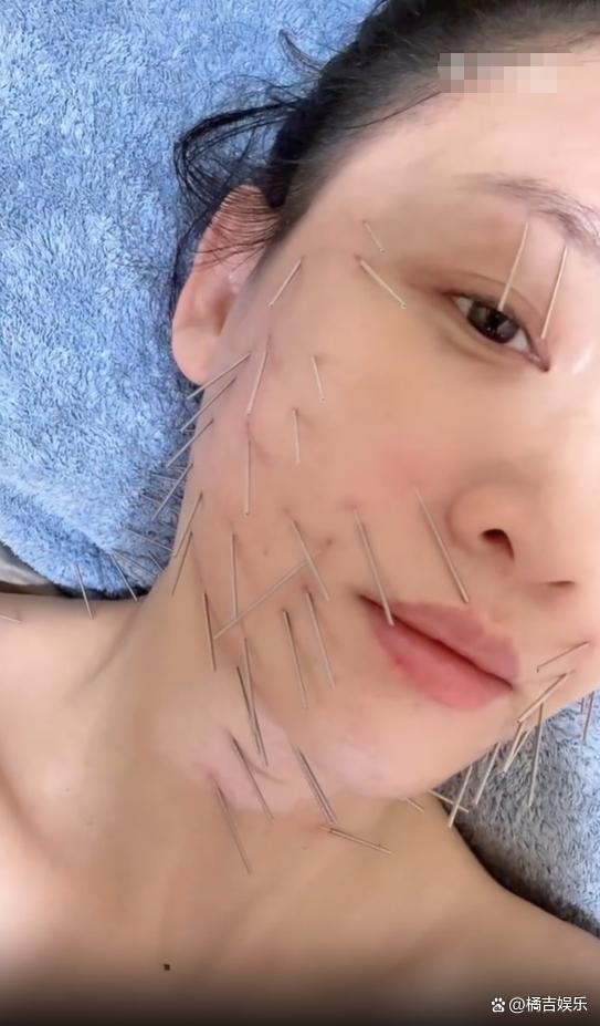 46歲陳喬恩曬做針雕保養(yǎng)照曝光