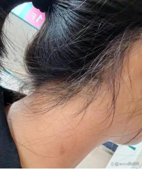 13歲女生被教官拳打腳踢,，益陽警方介入調(diào)查 矯正機(jī)構(gòu)成噩夢