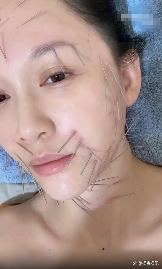 46歲陳喬恩曬做針雕保養(yǎng)照曝光