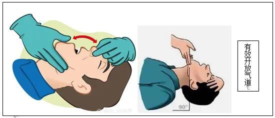 心肺复苏急救法教程一起来学习2