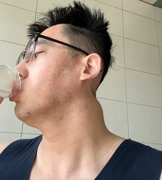 三次开颅、右眼失明、半脸面瘫！30岁抗癌北体大小伙，成了无数人的光 笑对命运的玩笑