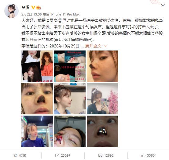 女演员高溜整容失败鼻子坏死 并面临200万违约赔偿