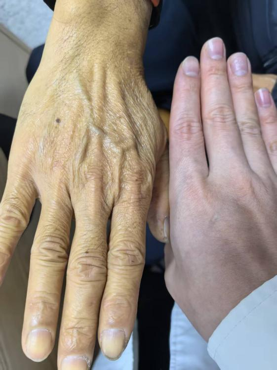 须眉得漠视病腹痛10年全身变黄