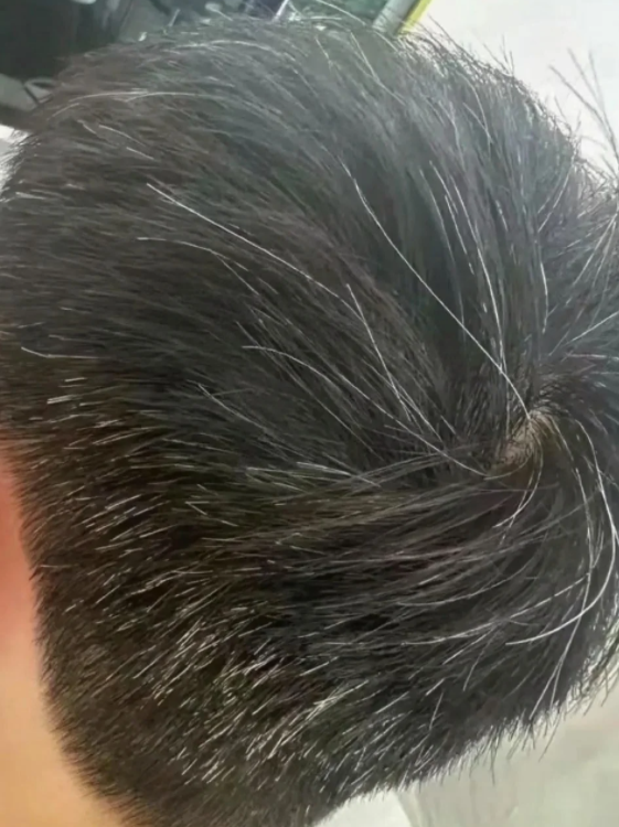 用脑过度容易长白头发？长白发是身体给的慢性压力警告