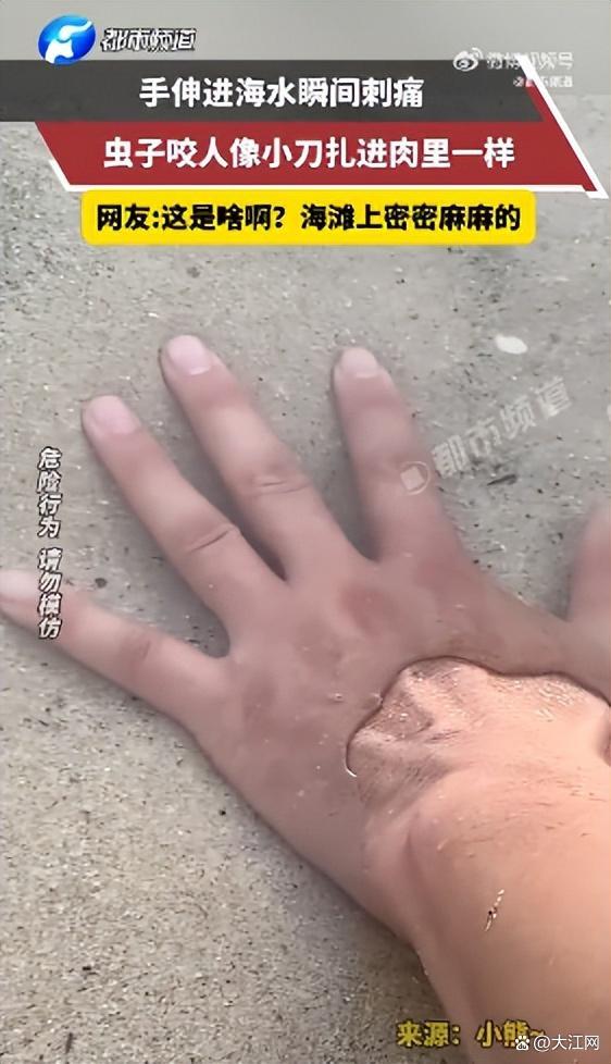 男子手伸海水被虫咬如刀扎