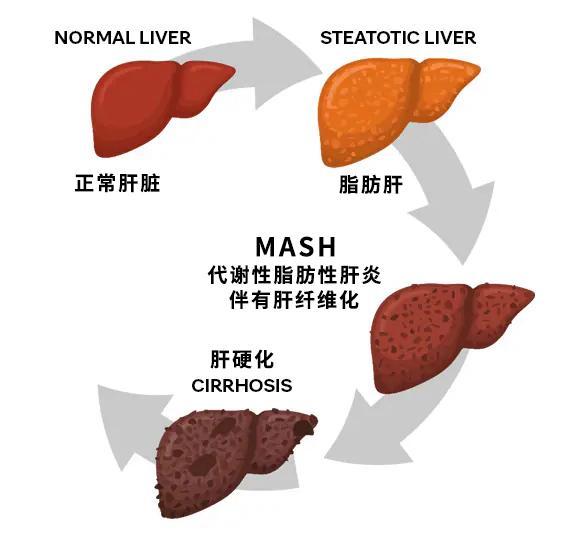 北大团队新研究：下午5点后禁食能“护肝”