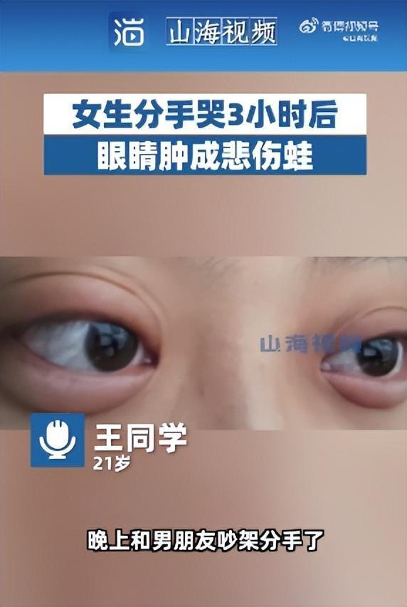女生哭3小时成“悲伤蛙” 网友：简直就是青蛙本蛙