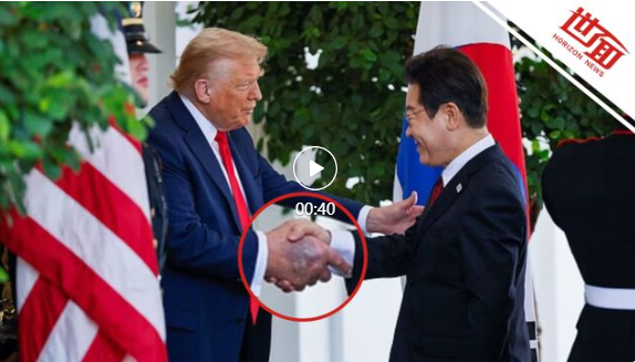特朗普手背淤青加重