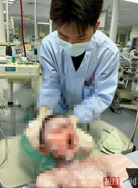 9岁男孩全身溃烂 病因竟是常用药 常见退热药引发严重反应