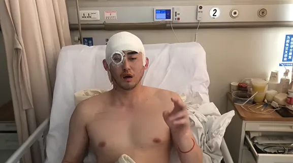 三次开颅、右眼失明、半脸面瘫！30岁抗癌北体大小伙，成了无数人的光 笑对命运的玩笑
