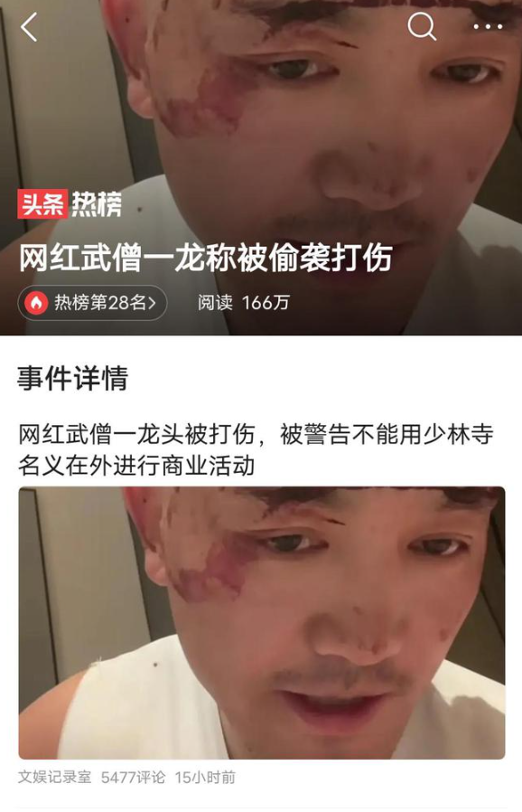 啥情况？！网红武僧一龙称被偷袭打伤