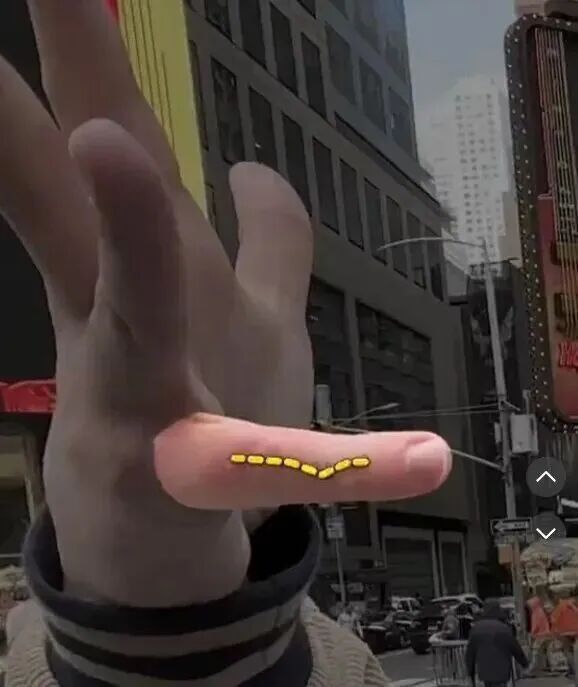 你用小拇指当手机支架吗？快改 避免关节变形