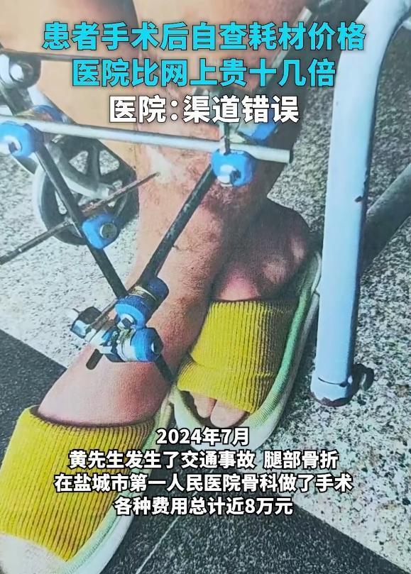 患者称术后发现耗材淘宝价不到医院的十分之一 价格差异引争议