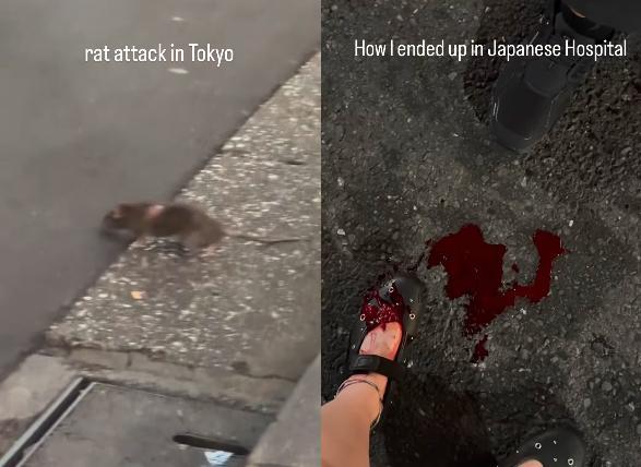 女游客日本街头被老鼠咬破头