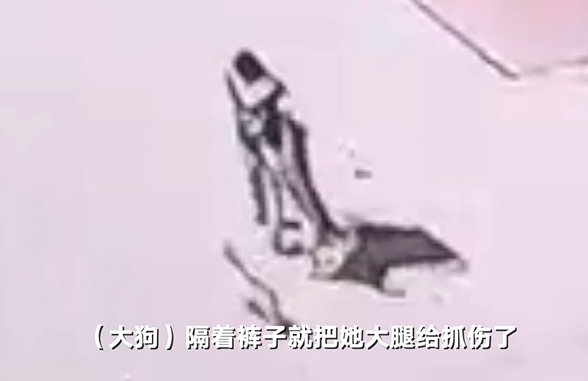 小孩保护宠物被大狗抓伤