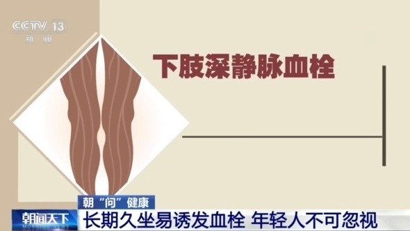 长期久坐易诱发血栓 这些信号要留意