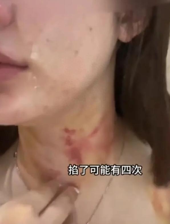 女子牵狗进电梯遭殴打衣服被扒光，警方展开调查