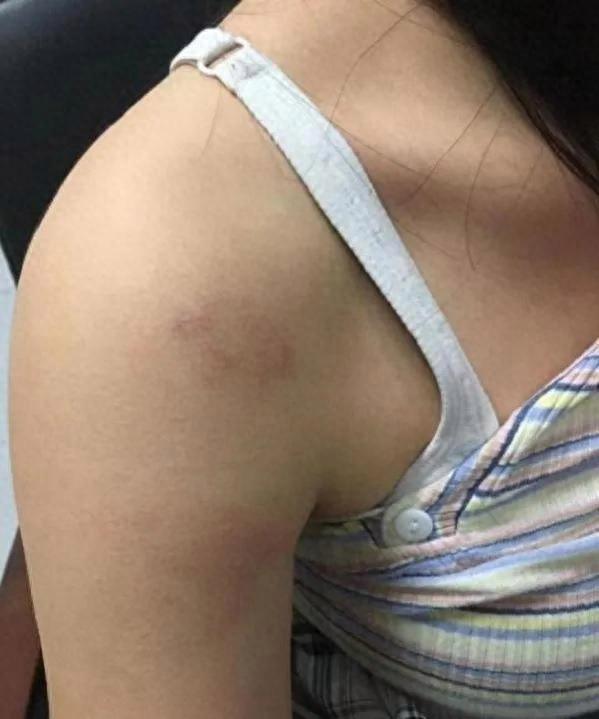 女子牵狗进电梯遭殴打衣服被扒光，警方展开调查
