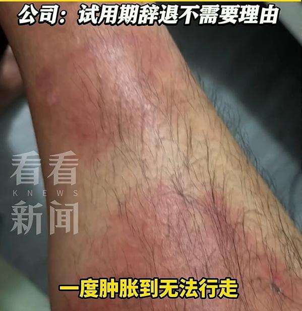 中国男子举报澳洲肉厂安全问题被辞