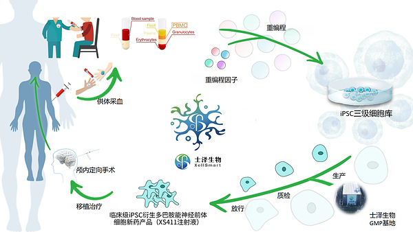 士泽生物通用型细胞新药治疗帕金森病注册临床II期全部入组完成