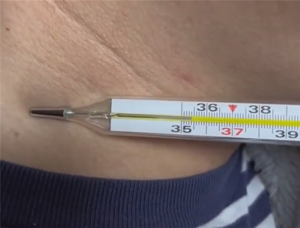 男子39.4度体温计刚放脖子就上升!快来看看高烧后如何缓解头疼