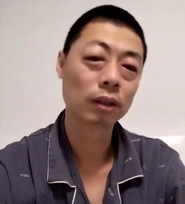 女子阳性后头发一夜变白