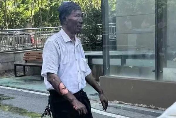 70岁保安冲入火场救火被灼成“雕像” ，为平凡英雄点赞！