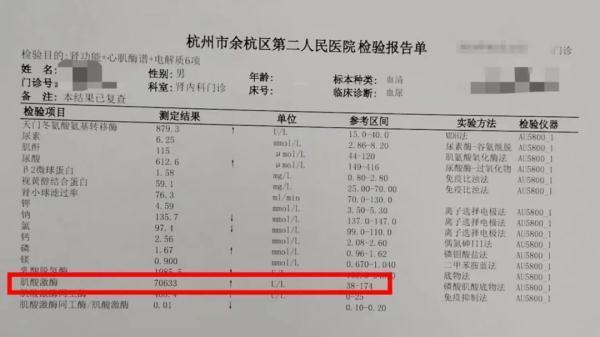 吓死人！20多岁小伙尿出“酱油” 超出正常值400倍