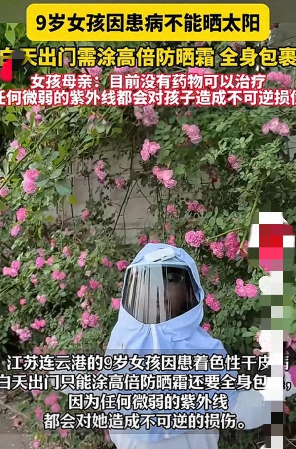 9歲女孩患罕見病不能曬太陽