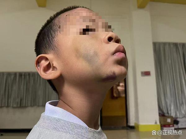 女子稱兒子遭生父繼母虐待