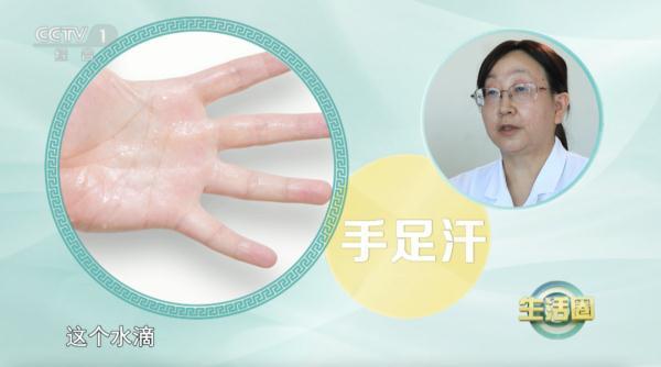 出汗部位暗示疾病風(fēng)險(xiǎn)可能身體出了問題