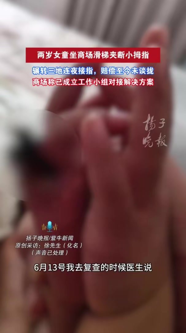 两岁女童坐商场滑梯夹断小拇指