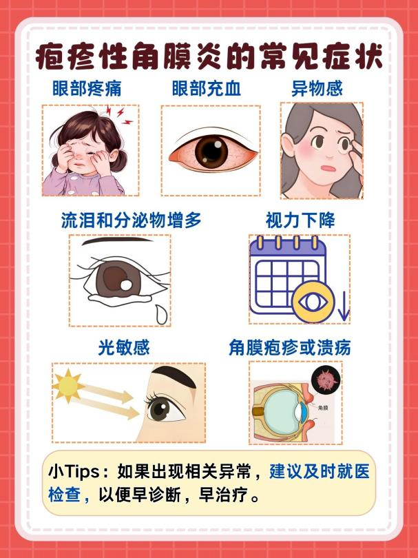 拆完快遞沒洗手，當(dāng)心“惹”上眼部帶狀皰疹