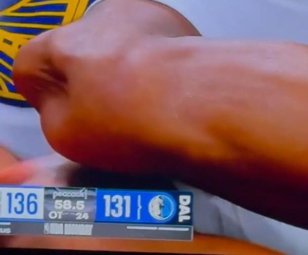 穆迪膝盖变形 比赛意外受伤