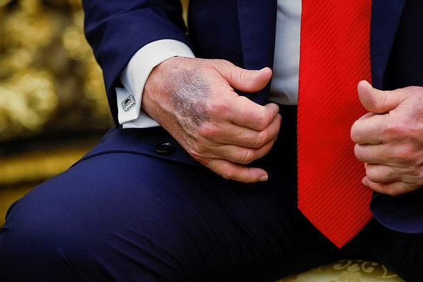 79岁特朗普再迎“年度体检”引关注 健康状况备受瞩目