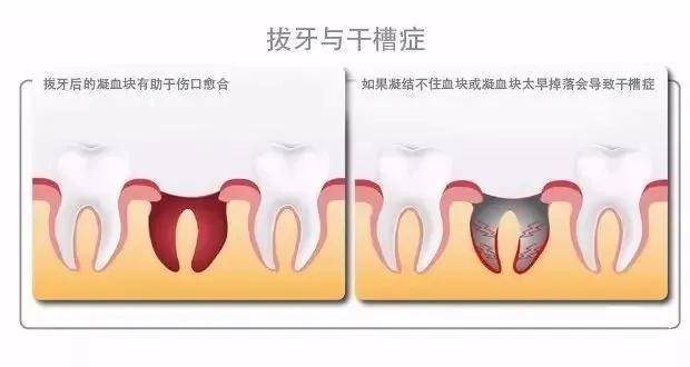 卫健局回应女子被一次性拔牙12颗 诊所操作引争议