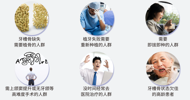 DIO种植体型号怎么选？亲水与非亲水种植体的区别与参考