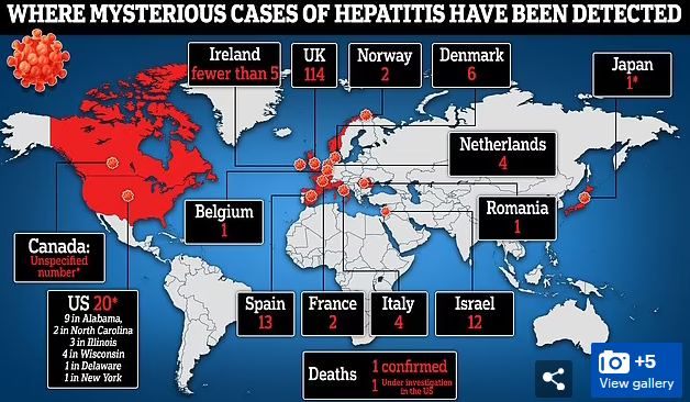 外媒：美国现不明儿童肝炎首例死亡病例