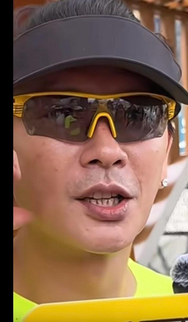 汤晶媚回应吐槽黄宗泽牙龈 言论引发两极讨论