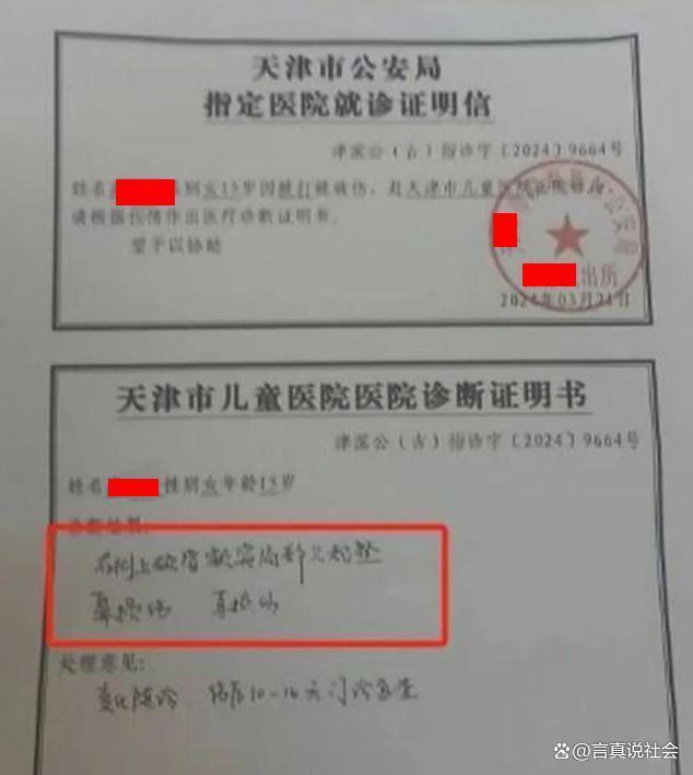 相关爆料的诊断书显示:右侧上颌骨额突,局部欠规整,鼻损伤,耳损伤.